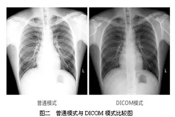 普通模式與DICOM模式比較圖