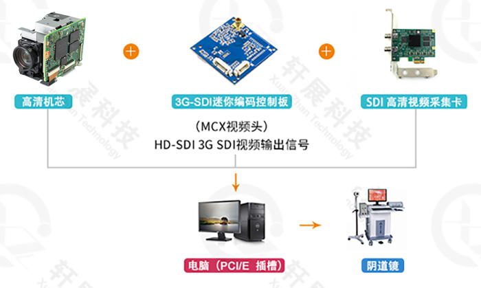 電子陰道鏡解決方案